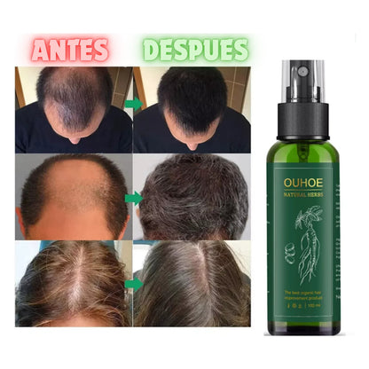 Spray anticaída con extracto de ginseng natural - resultado en cuero cabelludo